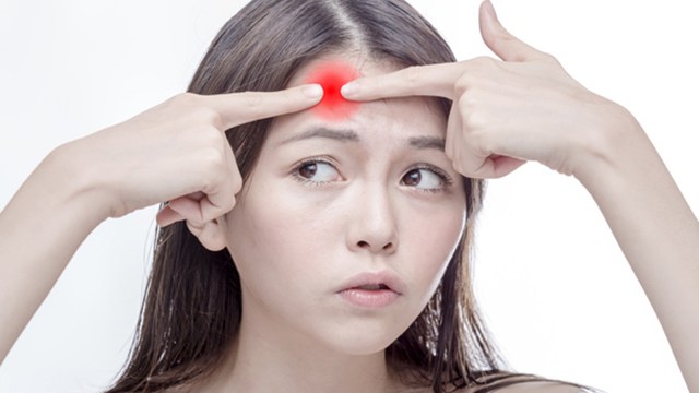 痘友不必再受苦！　除粉刺痘痘專利新技術有解